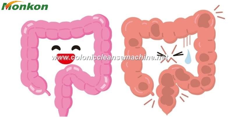 Hidroterapia de Colon Antes y Después: Resultados Reales en CDMX | Maikong 3 Hidroterapia de Colon Antes y Después
