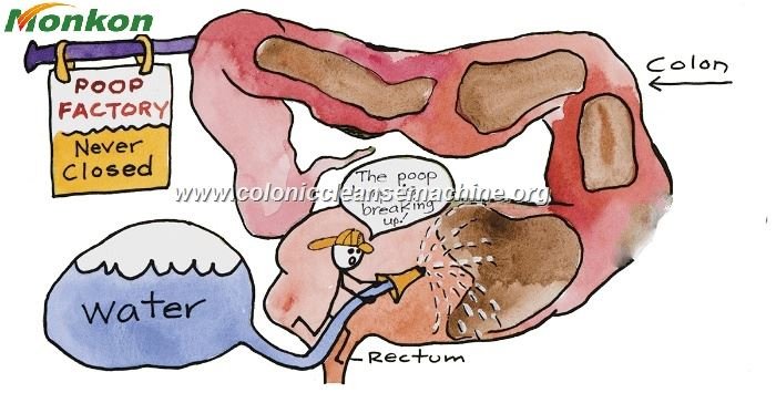 Que es la Hidroterapia de Colon 172