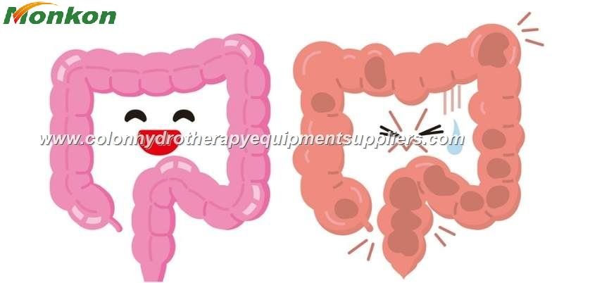 Hidroterapia de Colon en Zapopan