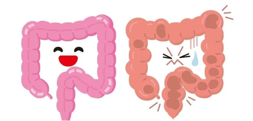¿Para qué sirve un "15 días cleanse" y cómo evaluarlo desde Aguascalientes (guía para asesores de salud)? 9 ¿Para qué sirve un "15 días cleanse" y cómo evaluarlo desde Aguascalientes (guía para asesores de salud)? — How Much Does Colonic Hydrotherapy Cost (62).jpg