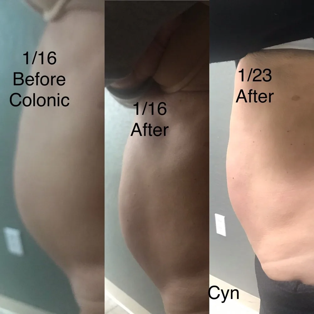 ¿Para qué sirve un "15 días cleanse" y cómo evaluarlo desde Aguascalientes (guía para asesores de salud)? 3 ¿Para qué sirve un "15 días cleanse" y cómo evaluarlo desde Aguascalientes (guía para asesores de salud)? — How Much Does Colonic Hydrotherapy Cost (1).jpeg