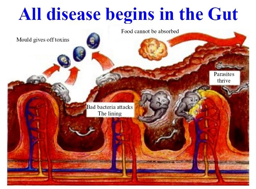 ¿Para qué sirve un "15 días cleanse" y cómo evaluarlo desde Aguascalientes (guía para asesores de salud)? 15 ¿Para qué sirve un "15 días cleanse" y cómo evaluarlo desde Aguascalientes (guía para asesores de salud)? — How Much Does Colonic Hydrotherapy Cost (101).jpg