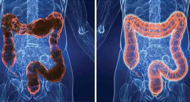 ¿Cuánto cuesta un lavado de colon? Costos de equipo y factores clave para compras en CDMX — colon hydro gerät preis，colon hydro therapie geräte preise (27).jpg